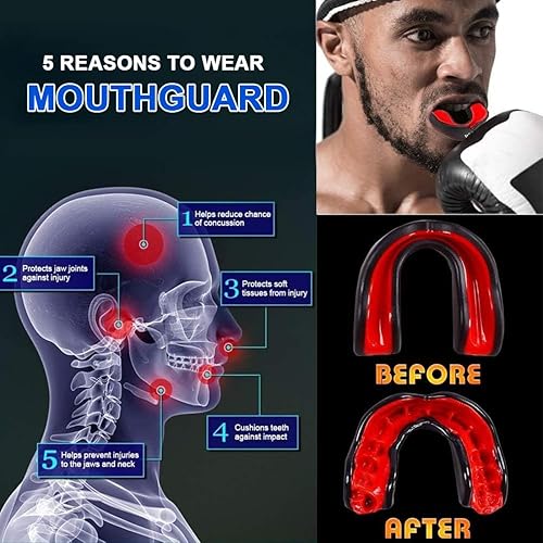 4 Pezzi Vestibilità Slim Paradenti Sportivo, Paradenti Kick Boxing, Paradenti Boxe,Premium Paradenti, per Rugby, Boxe, Arti Marziali, Hockey, Arti Marziali Miste, Taekwondo - Ysert