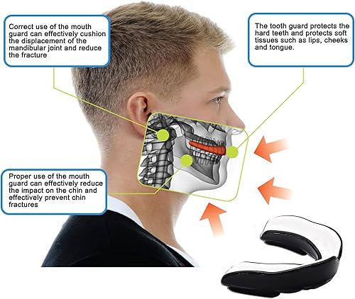 Paradenti in gomma – paradenti professionale per sport di contatto, rugby, arti marziali, karate, rugby, MMA, boxe, hockey, calcio flessibile per giovani e adult (White/Black, Adult(+12)) - Ysert
